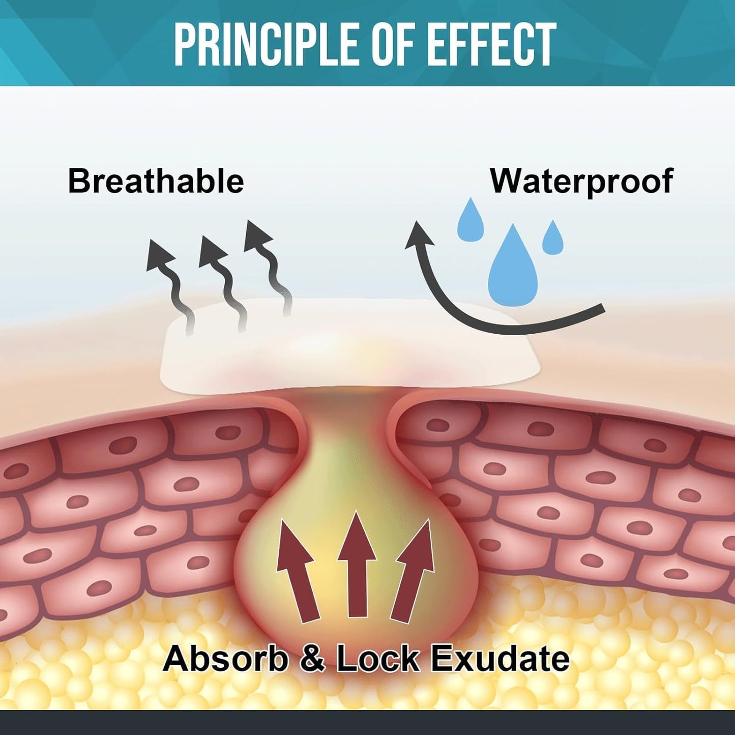 10 Pack Hydrocolloid Wound Dressing, 4" x 4" Ultra Thin Hydrocolloid Bandages with Self-Adhesive, Waterproof Hydrocolloid Patch for Bed Sore, Mild Burn, Blister, Acne Care